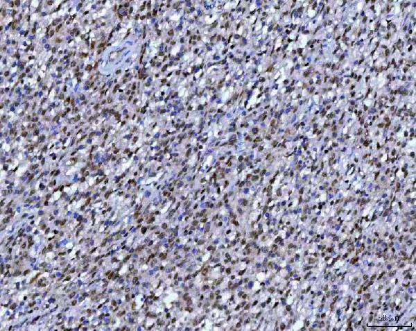  IHC analysis of RPRD1B using anti-RPRD1B antibody (A07903-1)