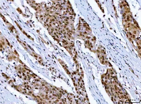 a07903 1 rprd1b primary antibodies ihc testing 4