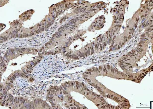 a07903 1 rprd1b primary antibodies ihc testing 5
