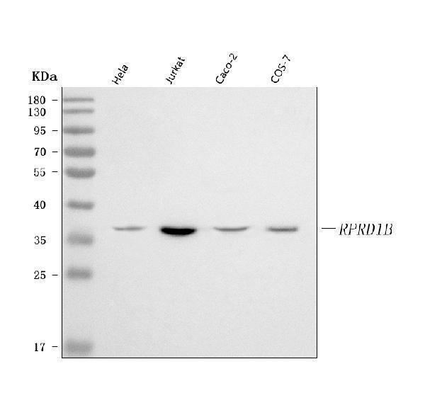  Western blot analysis of RPRD1B using anti-RPRD1B antibody (A07903-1)