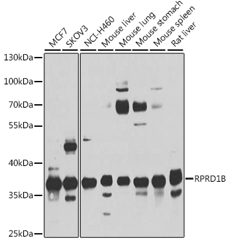 Western blot analysis of extracts of various cell lines, using rprd1b antibody  at 1:1000 dilution