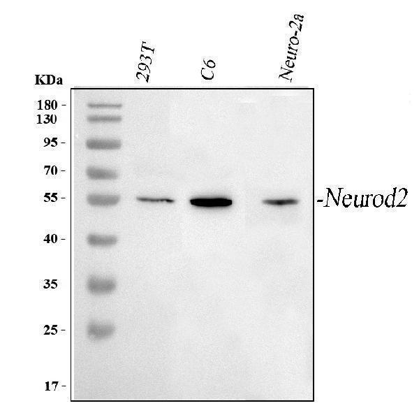  Western blot analysis of NEUROD2 using anti-NEUROD2 antibody (A07904-1)