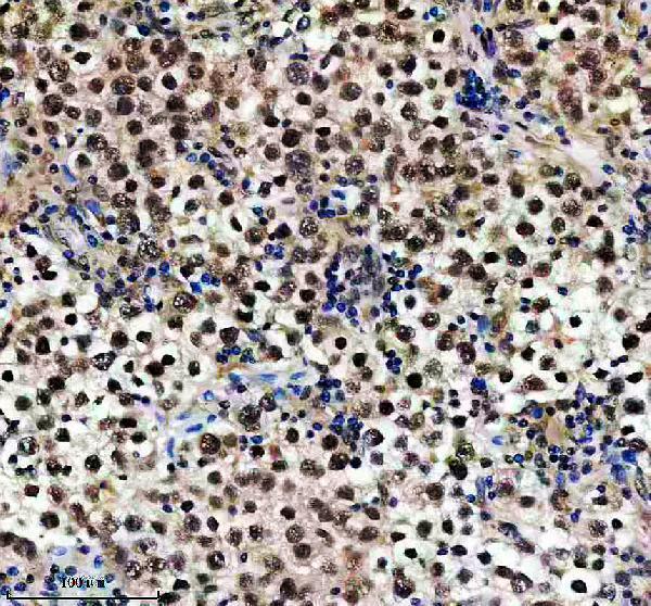 a07906 1 dzip1 primary antibodies ihc testing 2