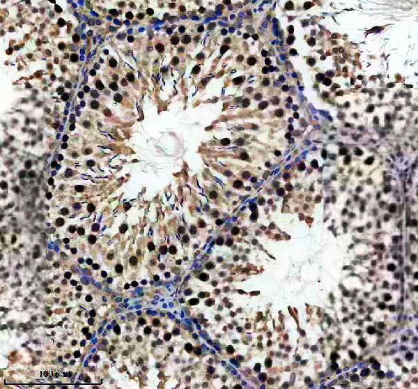 a07906 1 dzip1 primary antibodies ihc testing 3