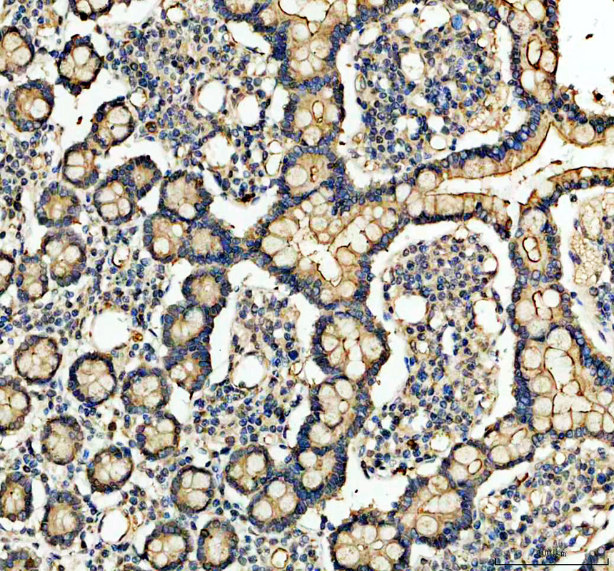 IHC analysis of MEP1A using anti-MEP1A antibody (A07908-1)