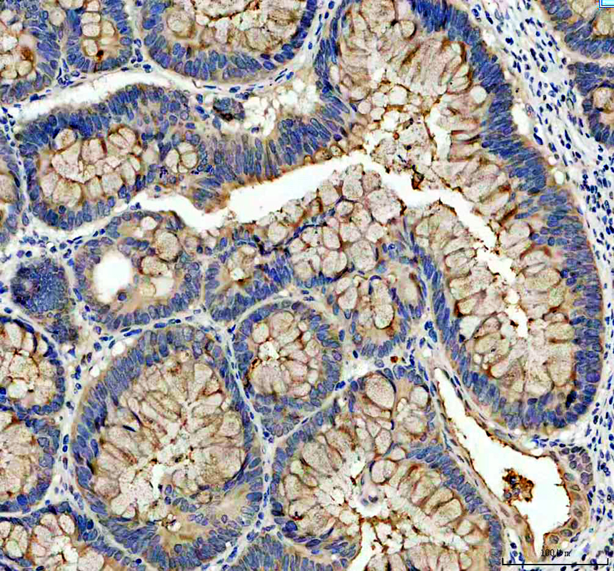 IHC analysis of MEP1A using anti-MEP1A antibody (A07908-1)