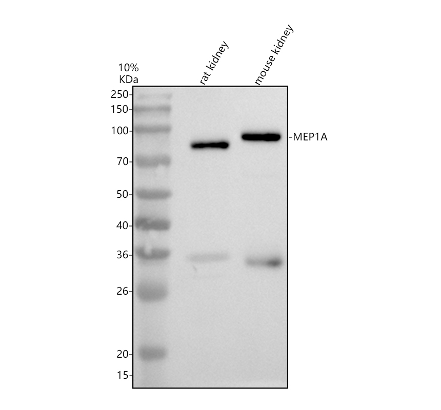 Western blot analysis of MEP1A using anti-MEP1A antibody (A07908-1)
