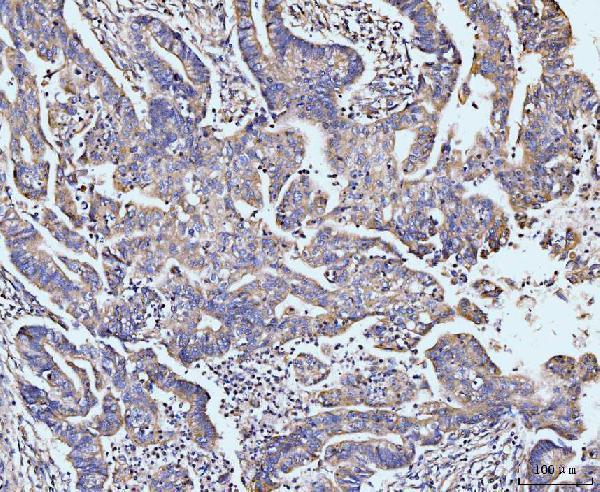  IHC analysis of MAP4K1/HPK1 using anti-MAP4K1/HPK1 antibody (A07909-3)