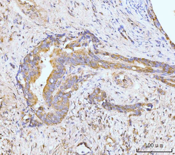  IHC analysis of MAP4K1/HPK1 using anti-MAP4K1/HPK1 antibody (A07909-3)