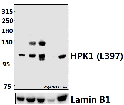 Western blot (WB) analysis of HPK1 (L397) pAb at 1:500 dilution
Lane1:HCC827 whole cell lysate(40ug)
Lane2:MCF-7 whole cell lysate(40ug)
Lane3:A549 whole cell lysate(40ug)
Lane4:H9C2 whole cell lysate(40ug)
Lane5:The Spleen tissue lysate of Mouse(40ug)