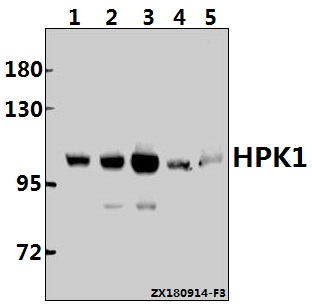 Western blot (WB) analysis of HPK1 (L397) pAb at 1:500 dilution
Lane1:A549 whole cell lysate(40ug)
Lane2:MCF-7 whole cell lysate(40ug)
Lane3:K562 whole cell lysate(40ug)
Lane4:RAW264
