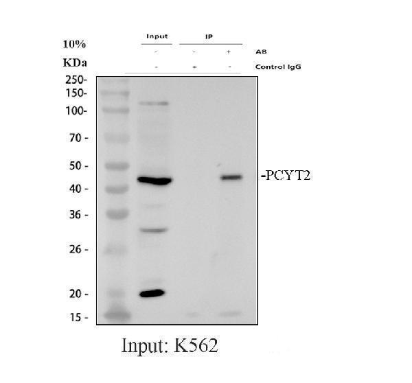 Immunoprecipitating (IP) PCYT2 in K562 whole cell lysate