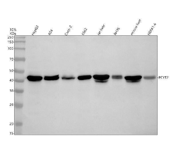 Western blot analysis of PCYT2 using anti-PCYT2 antibody (A07910-1)