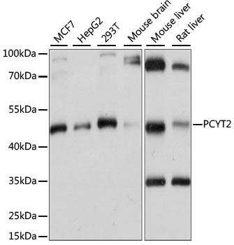 Western blot analysis of extracts of various cell lines, using PCYT2 antibody  at 1:1000 dilution