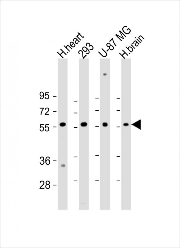 All lanes : Anti-ENTPD2 Antibody (N-term) at 1:2000 dilution Lane 1: H.heart lysate Lane 2: 293 whole cell lysate Lane 3: U-87 MG whole cell lysate Lane 4: H.brain whole cell lysate Lysates/proteins at 20 microg per lane. Secondary Goat Anti-Rabbit IgG, (H+L), Peroxidase conjugated at 1/10000 dilution. Predicted band size : 54 kDa Blocking/Dilution buffer: 5% NFDM/TBST. All lanes : Anti-ENTPD2 Antibody (N-term) at 1:2000 dilution Lane 1: H.heart lysate Lane 2: 293 whole cell lysate Lane 3: U-87 MG whole cell lysate Lane 4: H.brain whole cell lysate Lysates/proteins at 20 microg per lane. Secondary Goat Anti-Rabbit IgG, (H+L), Peroxidase conjugated at 1/10000 dilution. Predicted band size : 54 kDa Blocking/Dilution buffer: 5% NFDM/TBST.