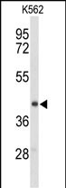 Western blot analysis of ENTPD2 Antibody (N-term) in K562 cell line lysates (35ug/lane). ENTPD2 (arrow) was detected using the purified Pab. Western blot analysis of ENTPD2 Antibody (N-term) in K562 cell line lysates (35ug/lane). ENTPD2 (arrow) was detected using the purified Pab.