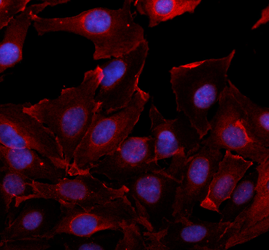 IF analysis of FREM2 using anti-FREM2 antibody (A07915-1)