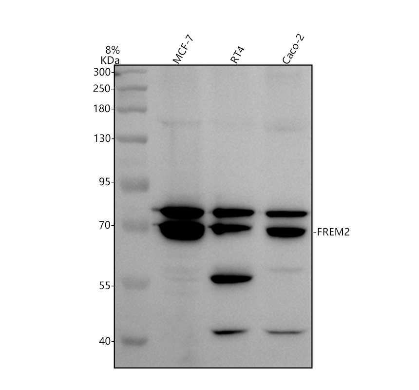 Western blot analysis of FREM2 using anti-FREM2 antibody (A07915-1)