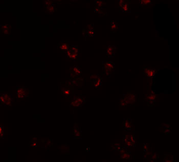 Immunofluorescence of FREM2 in A20 cells with FREM2 antibody at 20 μg/mL