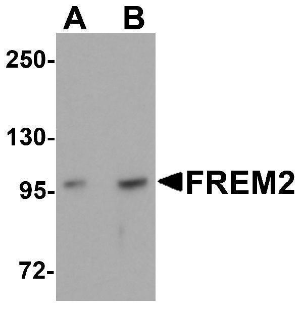Western blot analysis of FREM2 in A-20 cell lysate with FREM2 antibody at (A) 0