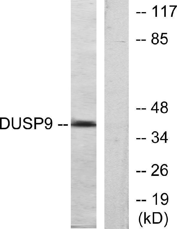 a07919 dusp9 primary antibodies wb testing 3