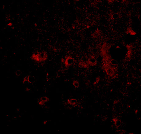 a07920 cadps2 primary antibodies if testing 3