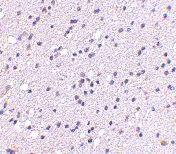 a07920 cadps2 primary antibodies ihc testing 2