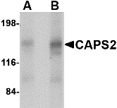 a07920 cadps2 primary antibodies wb testing 1