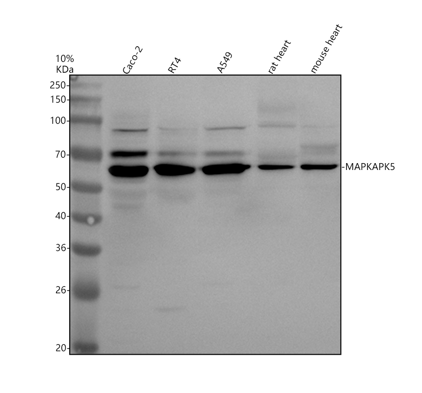 Western blot analysis of MAPKAPK5 using anti-MAPKAPK5 antibody (A07923-2)