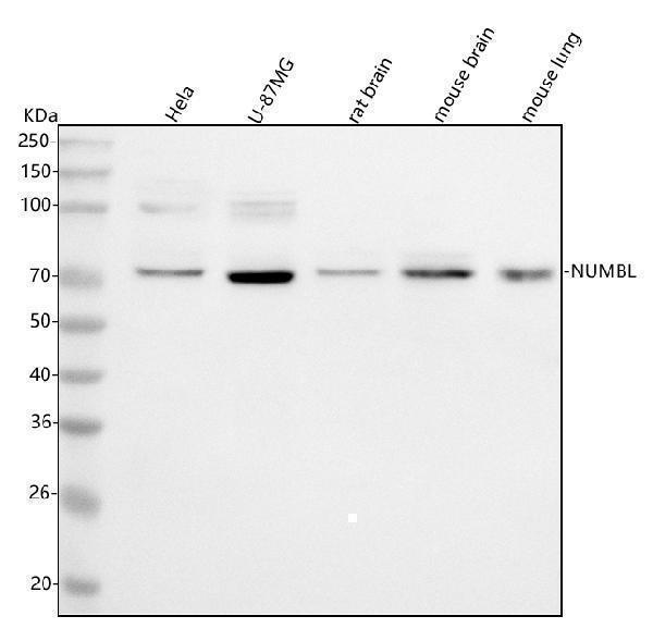  Western blot analysis of NUMBL using anti-NUMBL antibody (A07925)