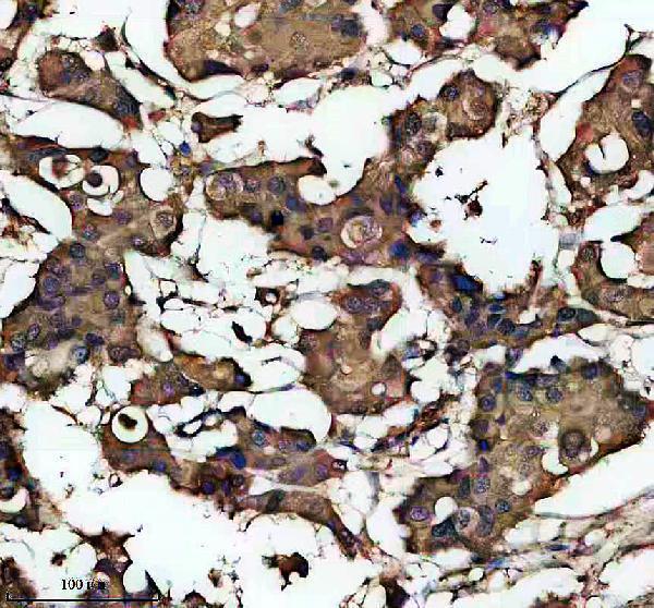 a07926 3 exoc7 primary antibodies ihc testing 1