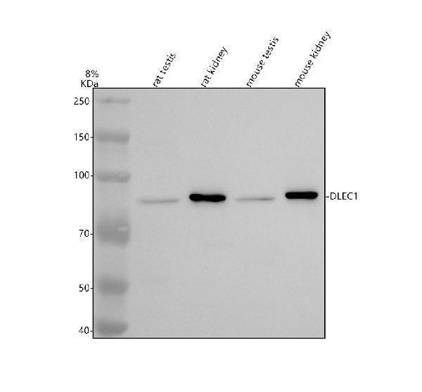 Western blot analysis of DLEC1 using anti-DLEC1 antibody (A07928-1)