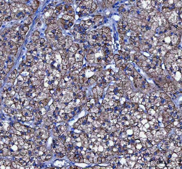  IHC analysis of LIN7C using anti-LIN7C antibody (A07929-1)