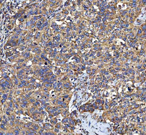  IHC analysis of LIN7C using anti-LIN7C antibody (A07929-1)