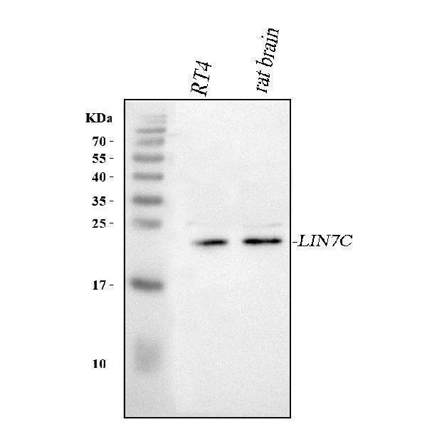  Western blot analysis of LIN7C using anti-LIN7C antibody (A07929-1)
