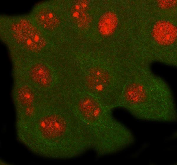  IF analysis of RFXANK using anti-RFXANK antibody (A07934) and anti-Beta Tubulin antibody (M01857-3)