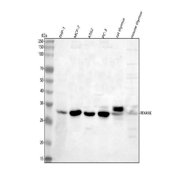  Western blot analysis of RFXANK using anti-RFXANK antibody (A07934)