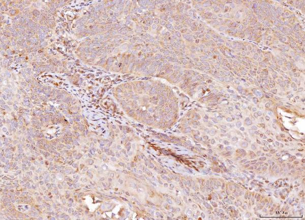  IHC analysis of NDUFB8 using anti-NDUFB8 antibody (A07936-1)
