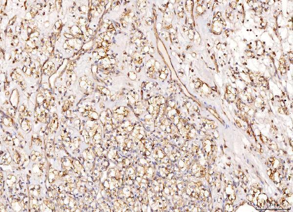  IHC analysis of NDUFB8 using anti-NDUFB8 antibody (A07936-1)