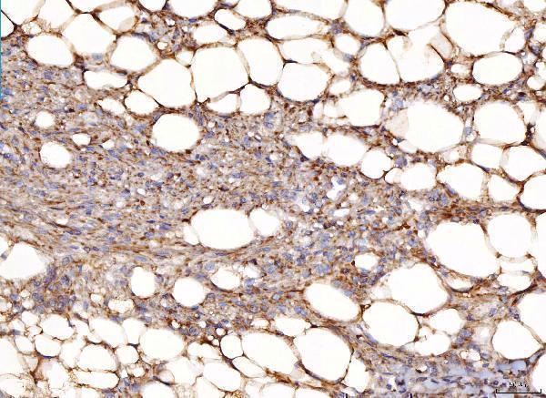 a07936 1 ndufbb primary antibodies ihc testing 4