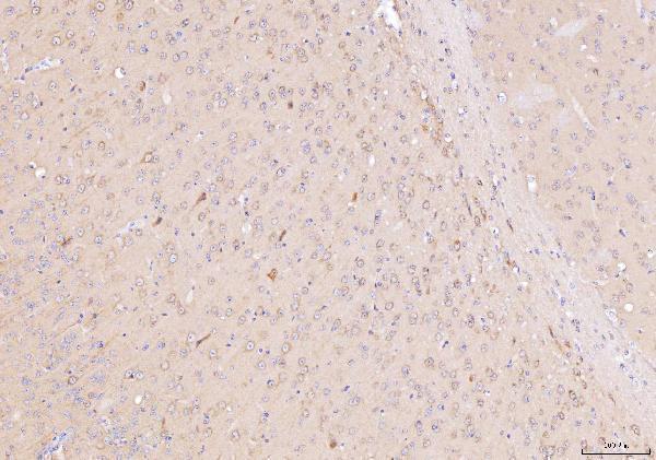 a07936 1 ndufbb primary antibodies ihc testing 5