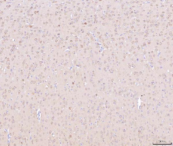 a07936 1 ndufbb primary antibodies ihc testing 6