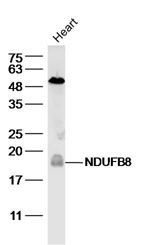 a07936 ndufb8 primary antiboties wb testing 1