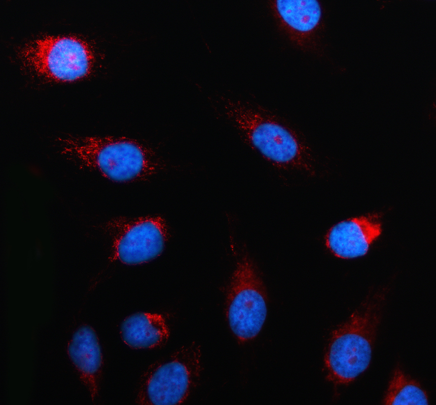 a07937 1 uqcrc2 primary antibodies if testing 1