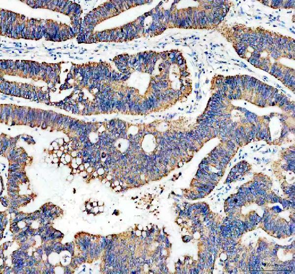 a07937 1 uqcrc2 primary antibodies ihc testing 1