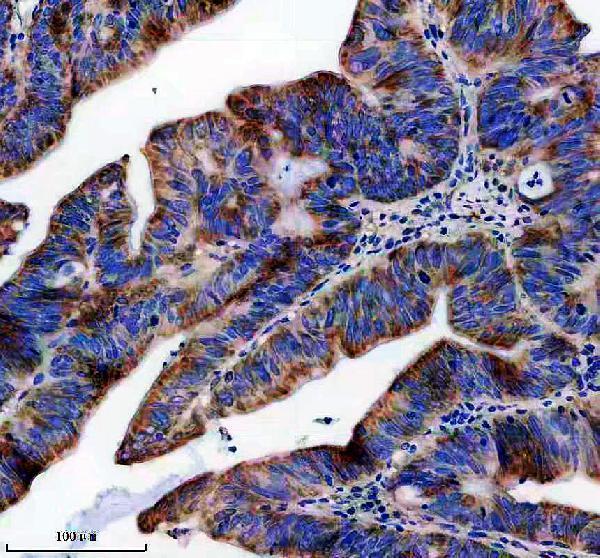IHC analysis of UQCRC2 using anti-UQCRC2 antibody (A07937-1)