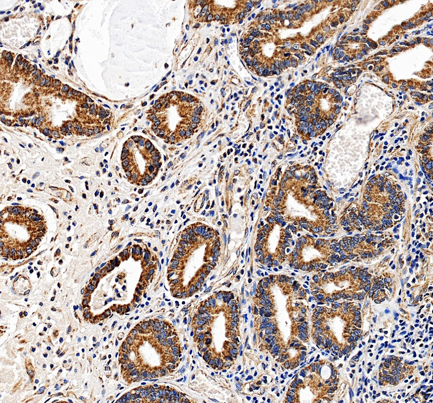 IHC analysis of UQCRC2 using anti-UQCRC2 antibody (A07937-1)