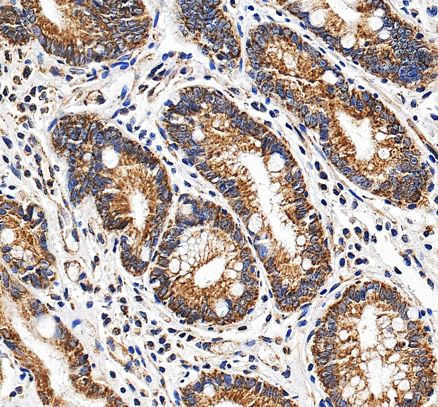 IHC analysis of UQCRC2 using anti-UQCRC2 antibody (A07937-1)