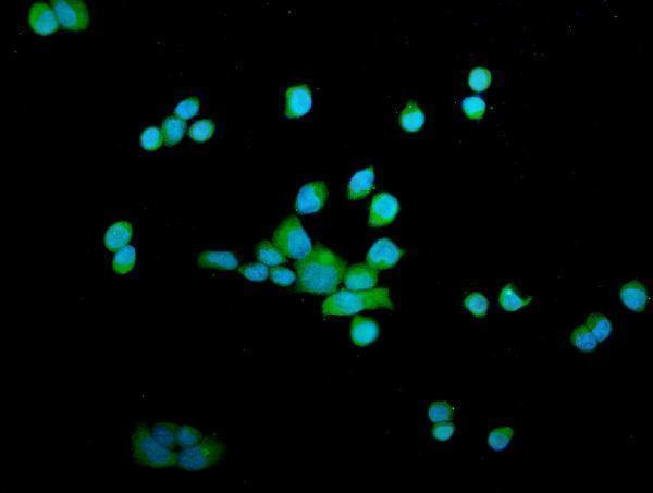 a07938 1 otulin primary antibodies if testing 1