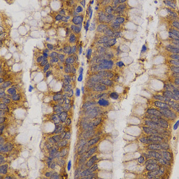 a07939 mmp25 primary antiboties ihc testing 2